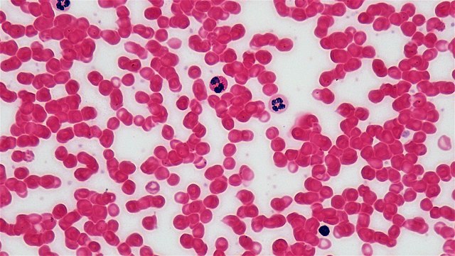 Blood smear under microscope