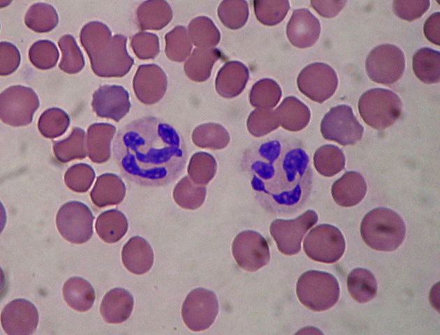 Different blood smear under microscope