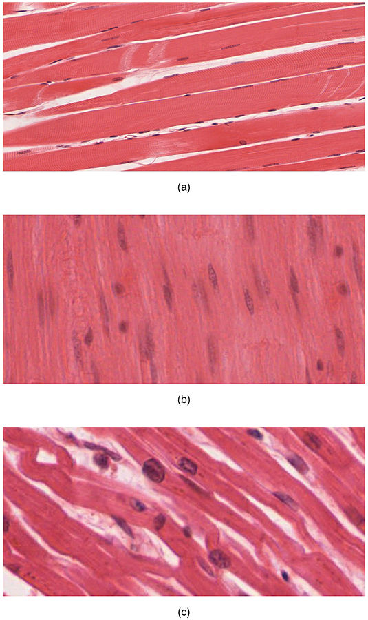 Skeletal muscle types under microscope