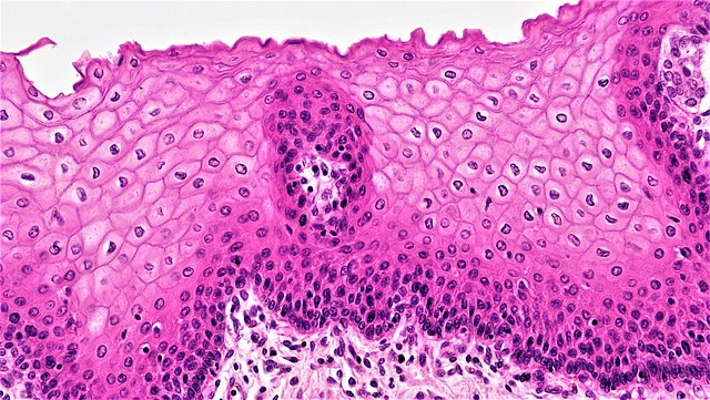 Stratified Squamous Epithelium under microscope