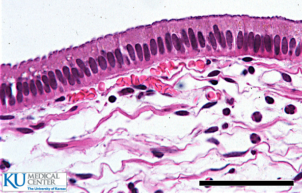 Simple Columnar Epithelium under microscope