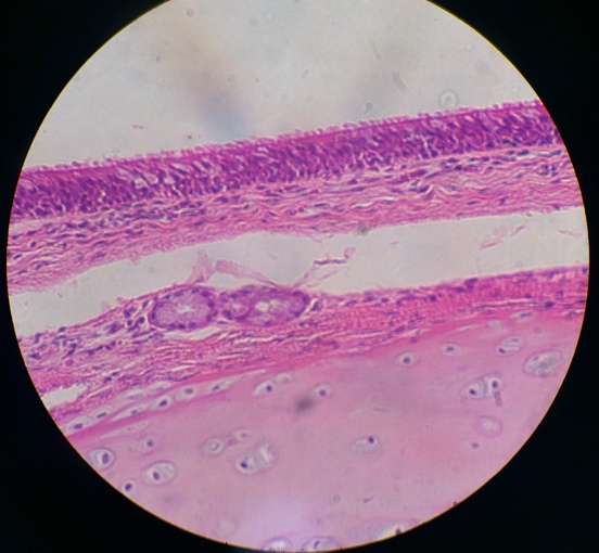 Pseudostratified Ciliated Columnar Epithelium under microscope