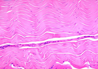 Dense regular connective tissue under microscope