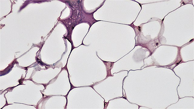 Adipose tissue under microscope