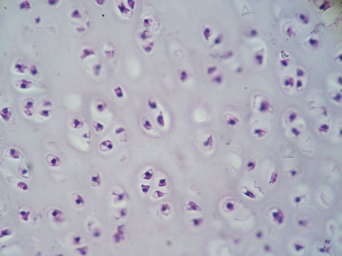 Hyaline cartilage under microscope